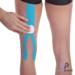 akuutnekinesio4
