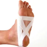 plantar1