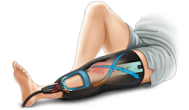 wraps-tech-knee-illustration Game Ready Laenutus -  erinevad mansetid - Image 6
