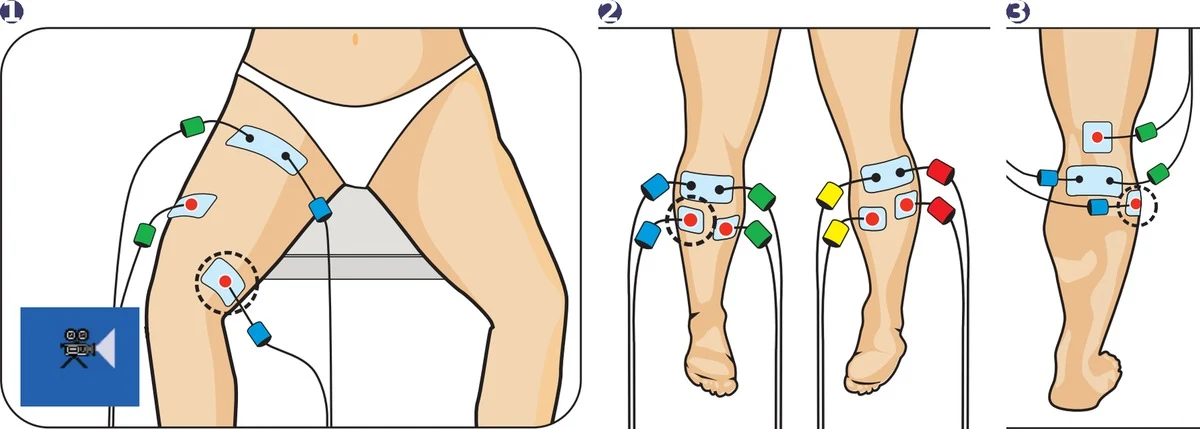 Chattanooga Rehab elektroodide asetus: lihasatroofia ja venoosne puudulikkus