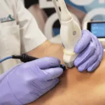physio invasiva 2.0