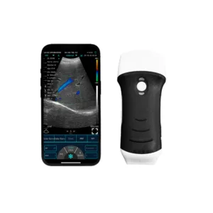 Sonophy Dual – mobiilne diagnostika ultraheliaparaat (konveks ja lineaaranduriga)