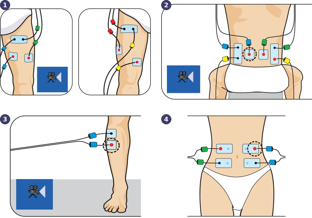 Chattanooga Theta elektroodide asetus: ACL, alaselg, hemipleegiline labajalg, kõhulihased