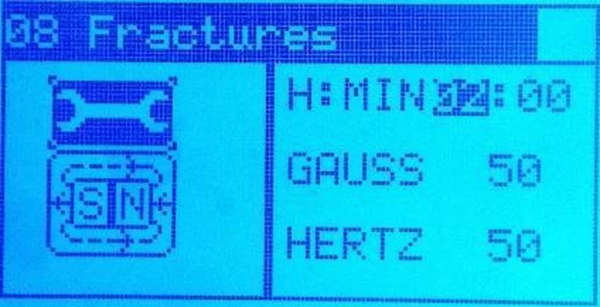 MAG2000 ekraan: programm, aeg, gauss ja hertz